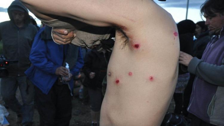 Represión en Chubut: 