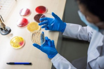 Científicos argentinos avanzan en un tratamiento contra el Síndrome Urémico Hemolítico