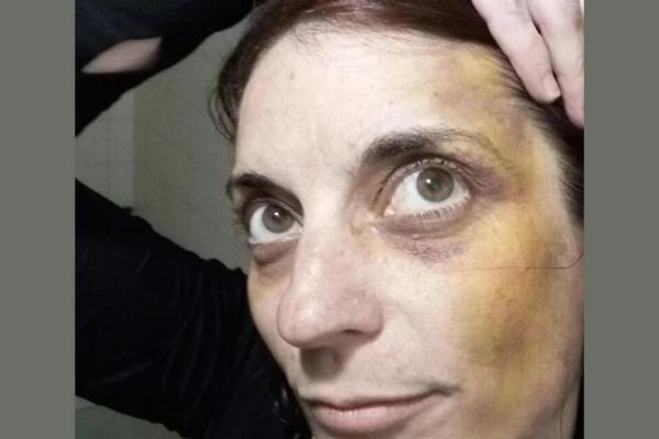 Habló la docente que protestó contra Morales en Jujuy y fue torturada: "Sentir que estaba muriendo"