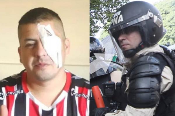 Se conoció un video que muestra al efectivo que le disparó al manifestante que perdió la visión de un ojo
