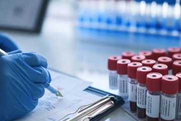 Preocupación: la variante Frankenstein del COVID ya circula en nuestro país, se detectaron tres casos del sublinaje XFG