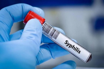 Foto de Preocupacin por el brote de sfilis en Argentina: cifras rcord en jvenes y adultos