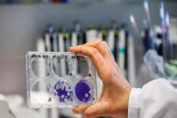 Foto de Alarmante: Mendoza confirm� la primera muerte en el pa�s por gripe H3N2